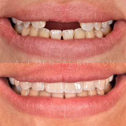 Ace Dental Boston