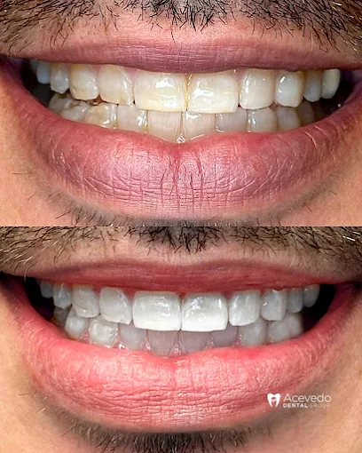Acevedo Dental Group Montebello
