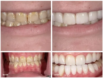 Aesthetic Smile Design