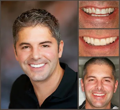 Aesthetic Smile Designs
