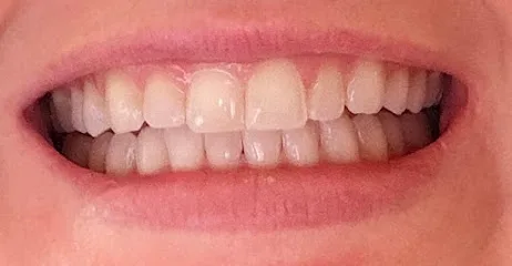 Art of Cosmetic Dentistry