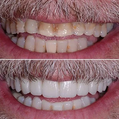 Artistry In Dentistry