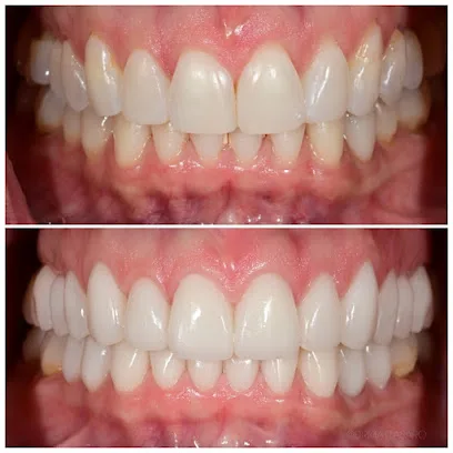 Asaro Dental Aesthetics