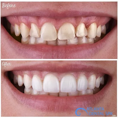 Atlanta Dental Spa - Highlands