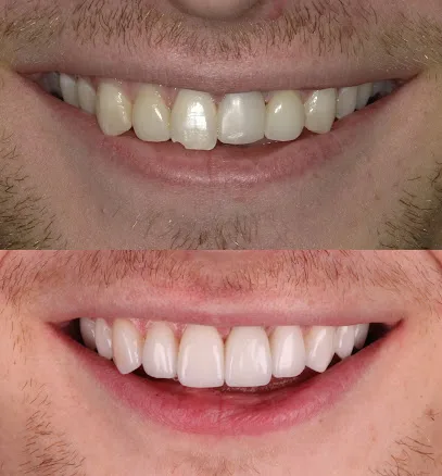 Austin Artistic Dental