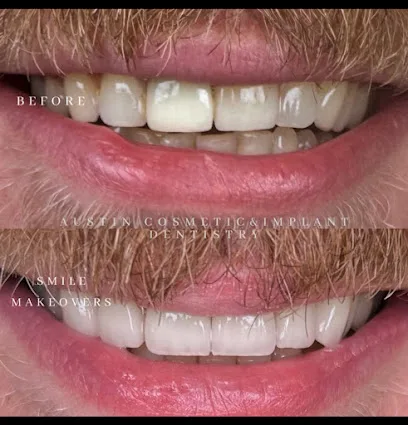Austin Cosmetic and Implant Dentistry