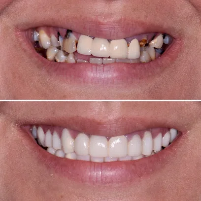 Austin Cosmetic Dentistry by Tejas Patel, DDS
