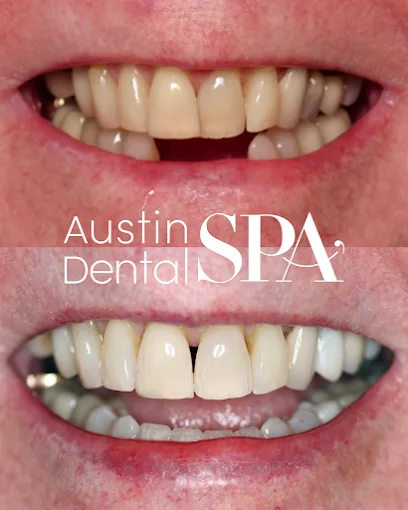 Austin Dental Spa
