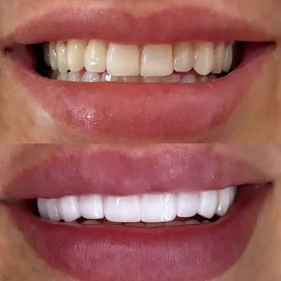 Brentwood Dental Spa - General, Veneers, Invisalign, Implants & Emergency Dentist