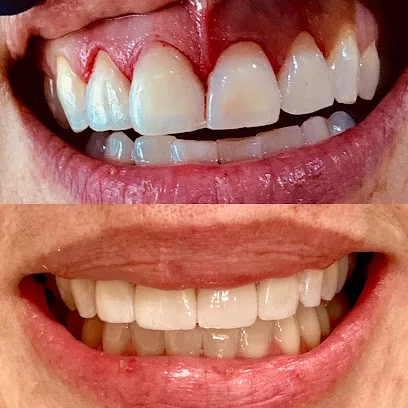 Bridgeport Aesthetic Dentistry - Dr. Ali Salmassian, DDS