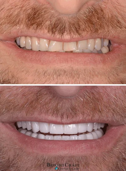 BrightCraft Dental & Laser