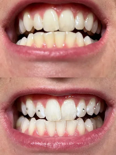 Brighten Up - Cosmetic Teeth Whitening