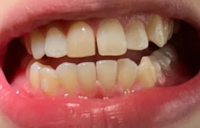 Brilliant Smiles Family Dental