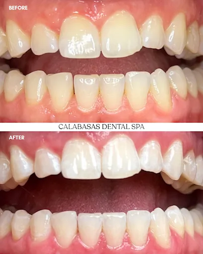 Calabasas Dental Spa
