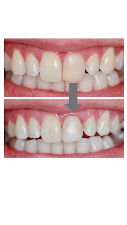 Carroll Family and Cosmetic Dentistry