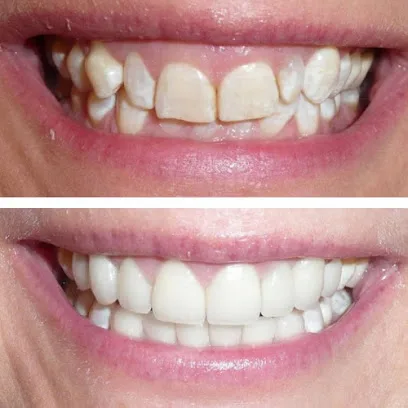 Cosmetic Dentist Huntington Beach - Ayoub Dental Corp - Emergency Dentist Huntington Beach CA - Dr. Sam Ayoub, DDS