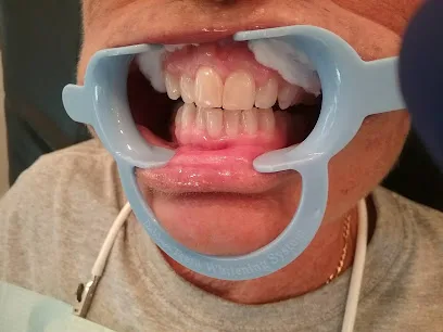 DaVinci Teeth Whitening of Venice