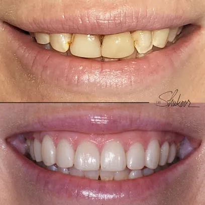 DC Smile and Veneers