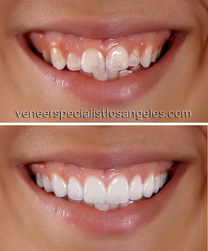 Dental Veneers Specialist On Wilshire - Los Angeles Cosmetic Dentist