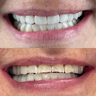 Diamond Dental Spa- Implants , Invisalign and Cosmetic Dentist Woodland Hills