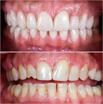 Dr. Anthony Mobasser - Celebrity Dentist