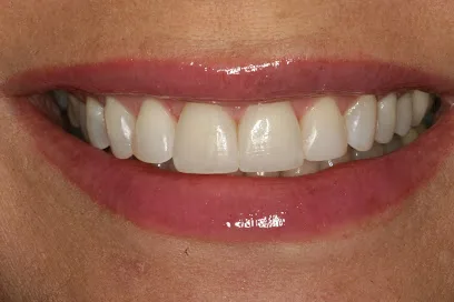 Dr. David Newkirk - Cosmetic and General Dentistry