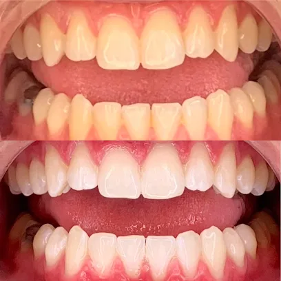 Edelweiss Teeth Whitening, LLC