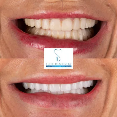 Elite Dentistry Cosmetic & Implant Center of ATX