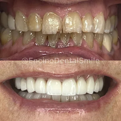 Encino Dental Smile
