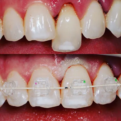 Esthetic Dentistry Pittsburgh