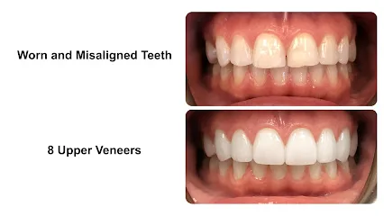 Esthetic Dentistry