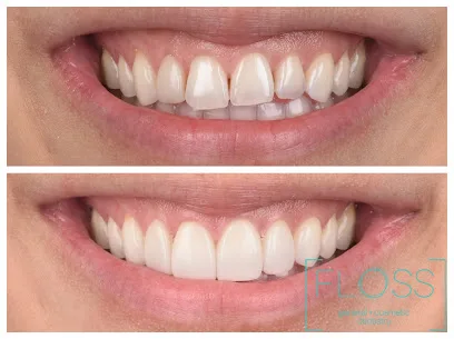 FLOSS general + cosmetic dentistry