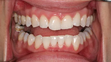 Gorgeous Smile - Arlington Cosmetic Dentist
