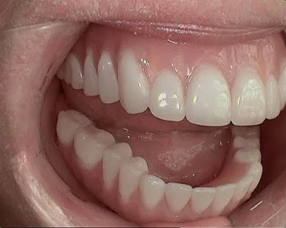 Healthy Living Dental in Ventura