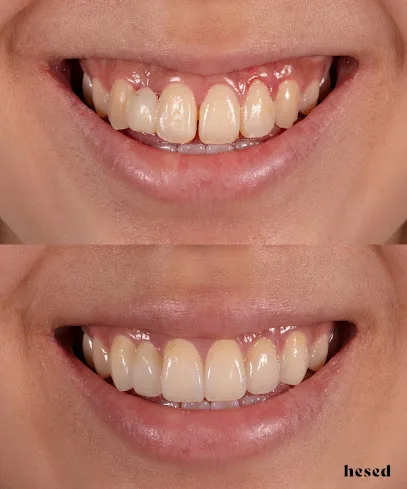 Hesed Dental | Cosmetic dentistry NJ
