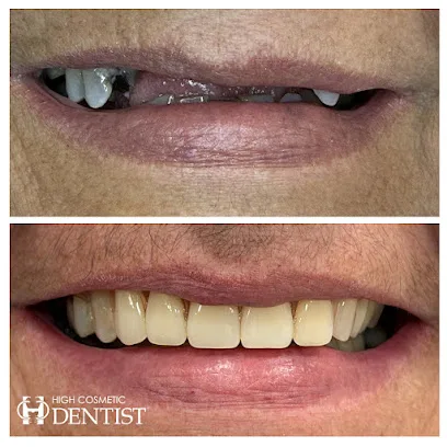 High Cosmetic Dentist