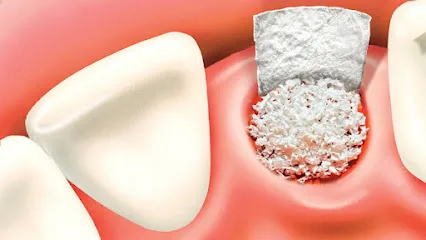 Hilltop Dental of Auburn