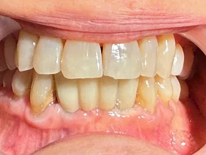 Irvine Family & Implant Dentistry