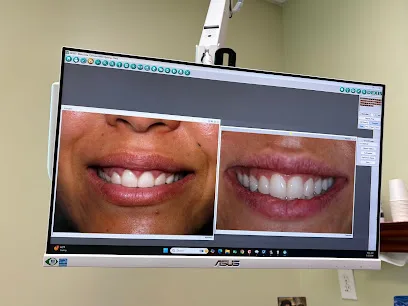 Irvine Smile Design