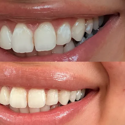 James Lin DMD: Los Gatos Dentist