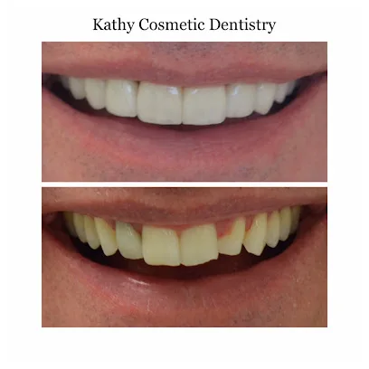 Kathy Cosmetic Dentistry