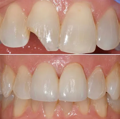 Laurel Bowie Implant & Cosmetic Dentistry