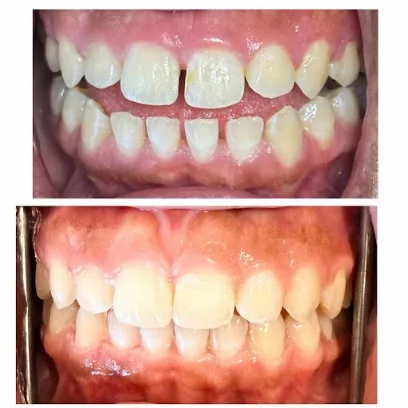 Laurel Smile Design, Amna Choudhary DDS