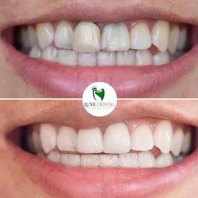Luxe Dental Cosmetics