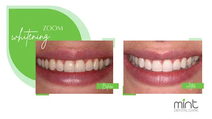 Mint Dental Care - Sunnyvale