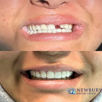 Newbury Dental Group