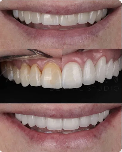 Newport Beach Dental Studio | Dr. Tai Ha, DDS