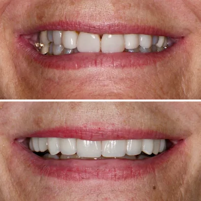 Newport Beach Dental