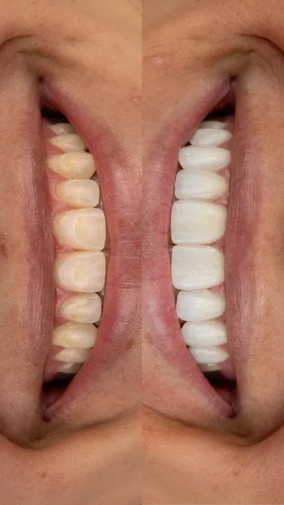 Pearce Dental Group of Edgewood, KY