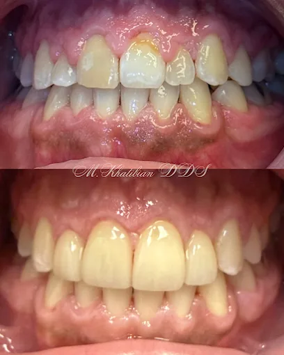 Pearly Dental Care